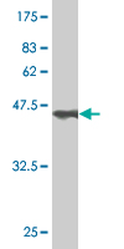 COMMD1 monoclonal antibody (M01), clone 2A12