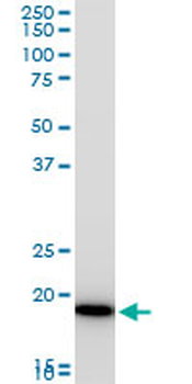 COMMD1 polyclonal antibody (A01)