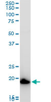 COMMD1 polyclonal antibody (A01)