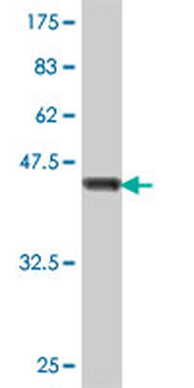 COMMD1 polyclonal antibody (A01)