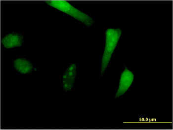 SIK1 monoclonal antibody (M01), clone 2C12