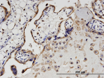SIK1 monoclonal antibody (M01), clone 2C12