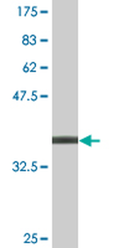 HFE2 monoclonal antibody (M01), clone 1C12