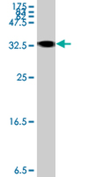 HFE2 polyclonal antibody (A01)