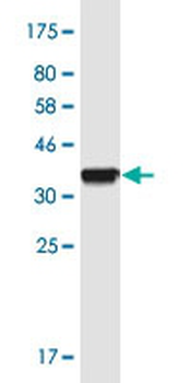 CDAN1 monoclonal antibody (M01), clone 7A10