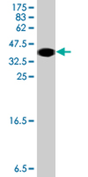 DYNLL2 polyclonal antibody (A01)