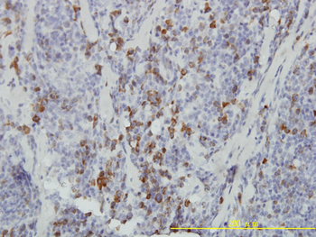 ASB9 monoclonal antibody (M01), clone 1D8