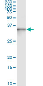 ASB9 monoclonal antibody (M01), clone 1D8