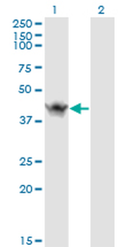 ASB9 monoclonal antibody (M01), clone 1D8