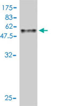 ASB9 monoclonal antibody (M01), clone 1D8