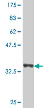 ACMSD polyclonal antibody (A01)