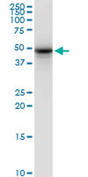 SYT2 monoclonal antibody (M01), clone 1G10