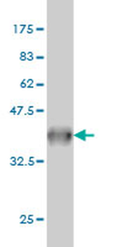 SYT2 monoclonal antibody (M01), clone 1G10