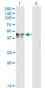 CANT1 monoclonal antibody (M01), clone 2D3