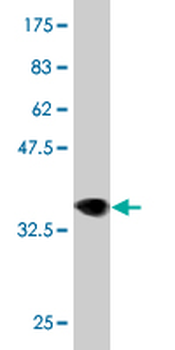 LRRK2 monoclonal antibody (M01), clone 3B2
