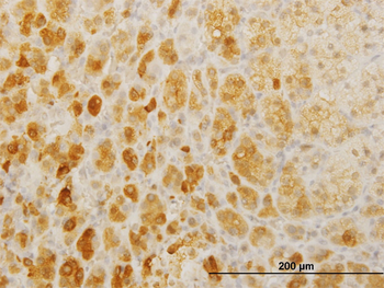 TWIST2 monoclonal antibody (M01), clone 3C8