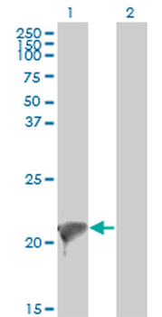 TWIST2 monoclonal antibody (M01), clone 3C8