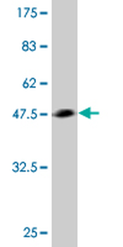 TWIST2 monoclonal antibody (M01), clone 3C8