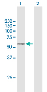 RAB3IP purified MaxPab mouse polyclonal antibody (B01P)