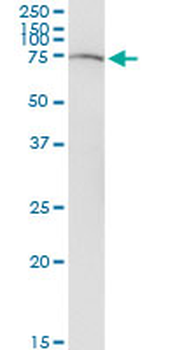 SLC22A12 monoclonal antibody (M02), clone 2B5