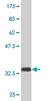 SLC22A12 monoclonal antibody (M02), clone 2B5