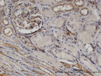 CTHRC1 monoclonal antibody (M05), clone 1G12