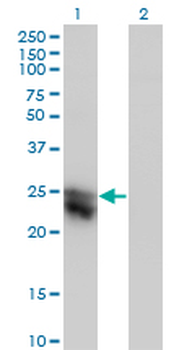 CTHRC1 monoclonal antibody (M05), clone 1G12