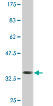 CTHRC1 monoclonal antibody (M05), clone 1G12