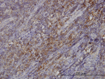 RASGRP4 monoclonal antibody (M01), clone 1F3