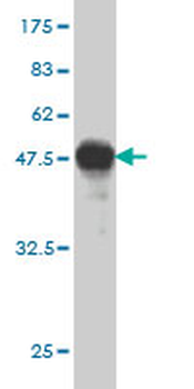 RASGRP4 monoclonal antibody (M01), clone 1F3