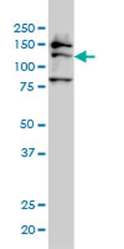 FMNL2 monoclonal antibody (M01), clone 2B4