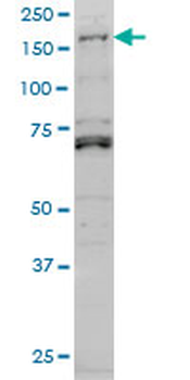 LMTK3 monoclonal antibody (M02), clone 2H6