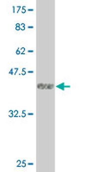 LMTK3 monoclonal antibody (M02), clone 2H6