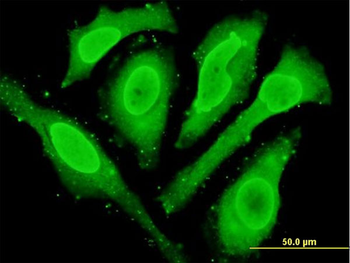 CYGB monoclonal antibody (M02), clone 1A1