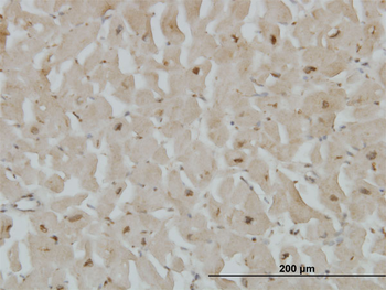 CYGB monoclonal antibody (M02), clone 1A1