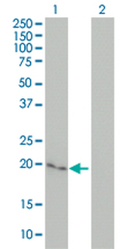 CYGB monoclonal antibody (M02), clone 1A1