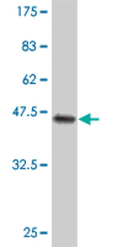 CYGB monoclonal antibody (M02), clone 1A1