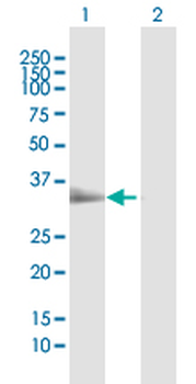 TIRAP MaxPab rabbit polyclonal antibody (D01)