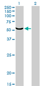TOE1 monoclonal antibody (M01), clone 1D8