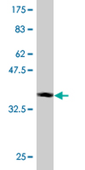 EPSTI1 monoclonal antibody (M02), clone 3G7