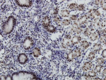 MGC21874 monoclonal antibody (M08), clone 1C8