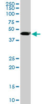 MGC21874 monoclonal antibody (M08), clone 1C8