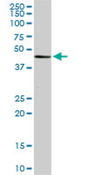 MGC21874 monoclonal antibody (M08), clone 1C8