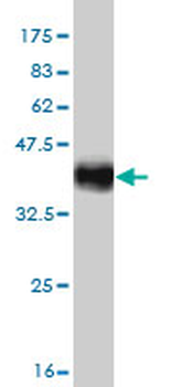 MGC21874 monoclonal antibody (M08), clone 1C8