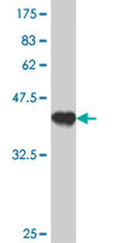 RHOT2 polyclonal antibody (A01)
