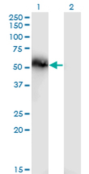 TNS4 monoclonal antibody (M01), clone 3B8