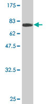 ZFYVE19 monoclonal antibody (M01), clone 4D5-2D11