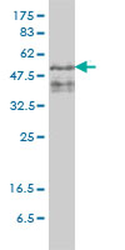 ZFYVE19 monoclonal antibody (M01), clone 4D5-2D11