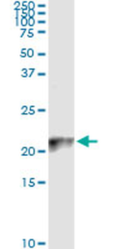 COX4I2 monoclonal antibody (M01), clone 1F2