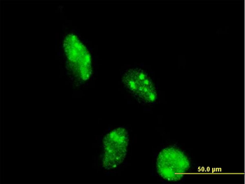 DOT1L monoclonal antibody (M01), clone 6A6